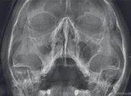 Центр диагностики челюстно-лицевой области Пикассо на Смольной улице Фото 1 на сайте Hovrino.info